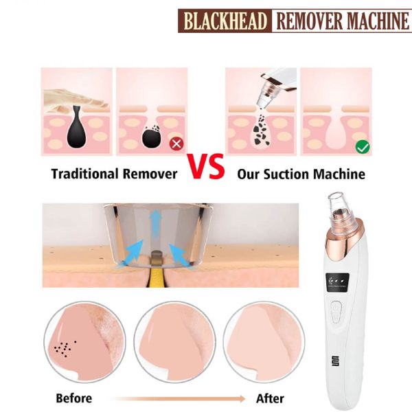 Adjustable-Speed-Chargeable-BlackHeads-Removal-Machine.jpg